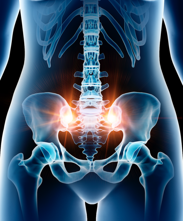 Everything You Need to Know About Yoga and Sacroiliac Joint Pain