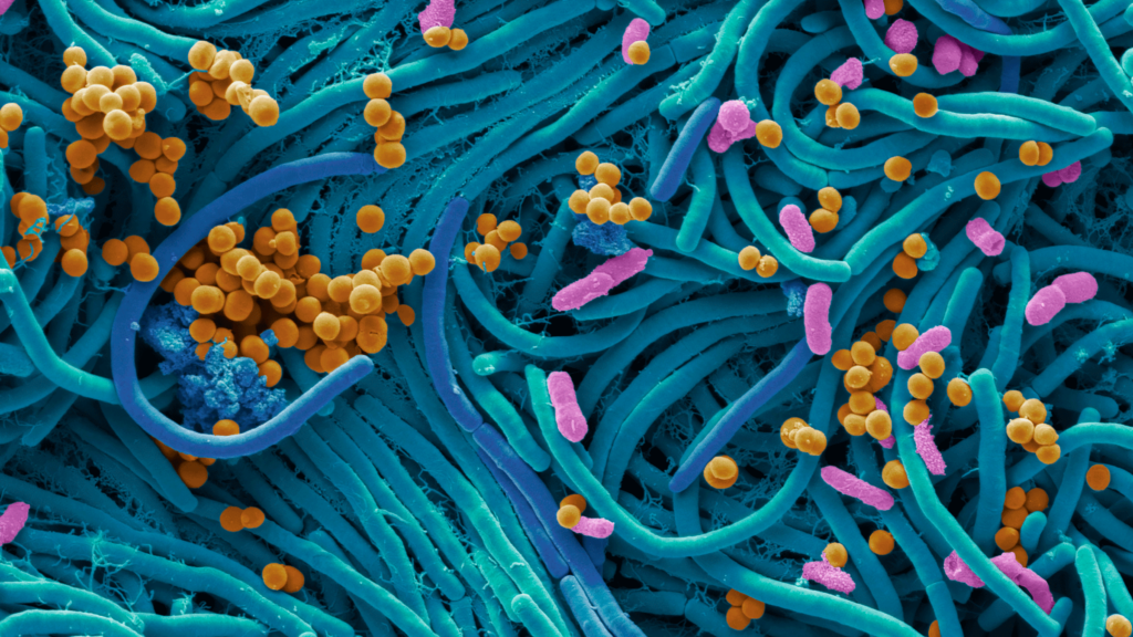 Microscopic look at bacteria, including kinds that can be found when you don't know how to clean yoga mat