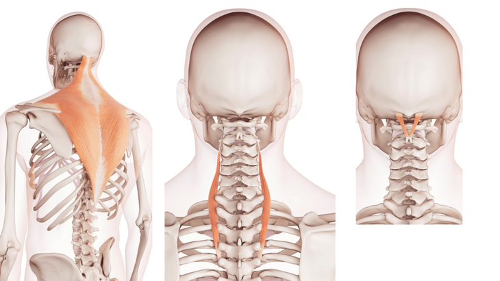 Anatomical illustrations of the muscles in the upper back, shoulder, and neck that can contribute to tension headaches